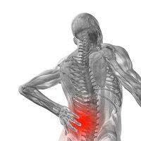 Glucosamine and Placebo Treatment Produce Similar Results in Low Back Pain