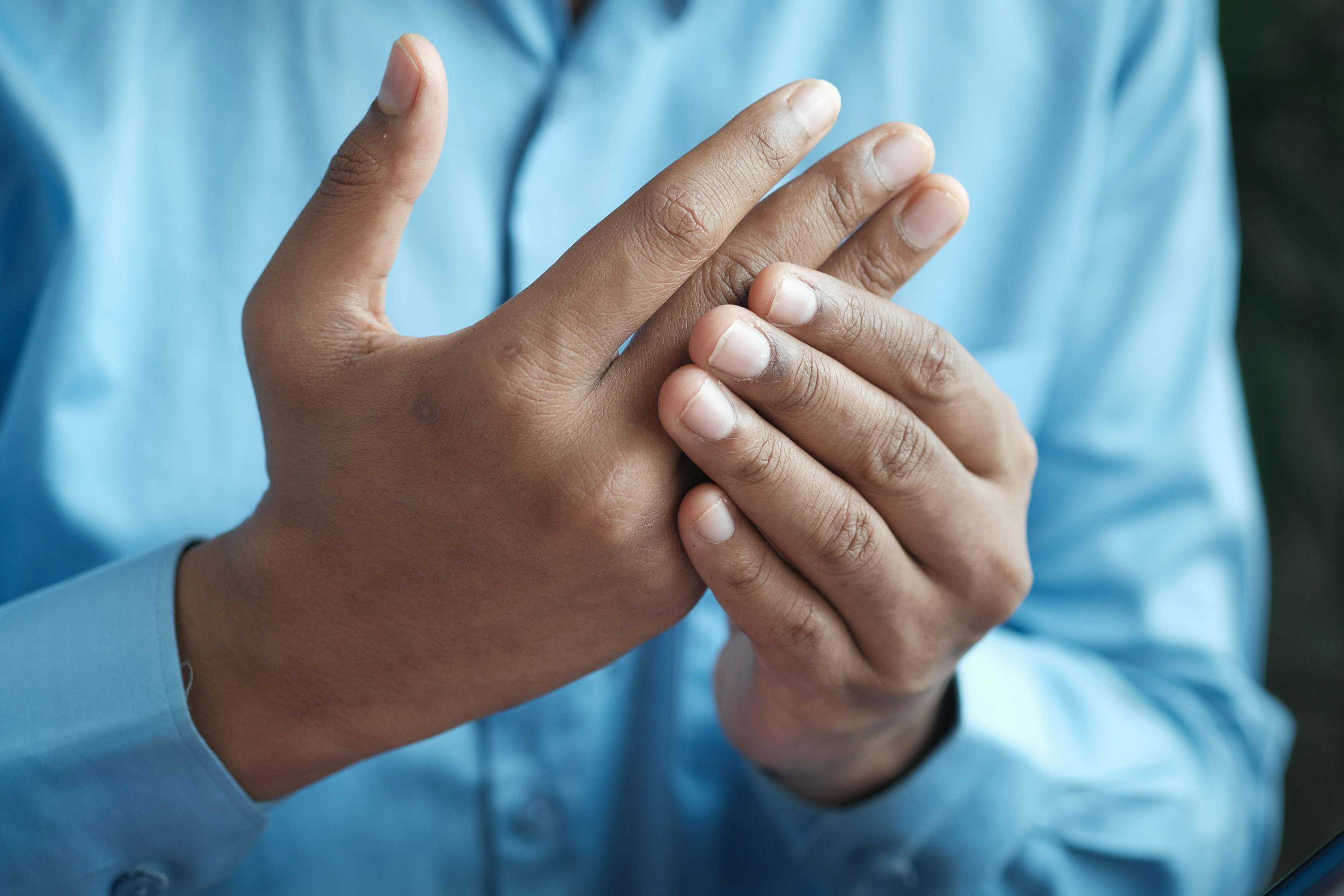 A male patient with gout and joint pain massaging his hand. | Credit: Unsplash