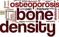 Osteoporosis Drugs' Mechanisms Differ