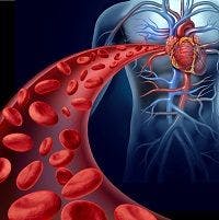 Increased Cardiovascular Risk Linked to Psoriatic Arthritis