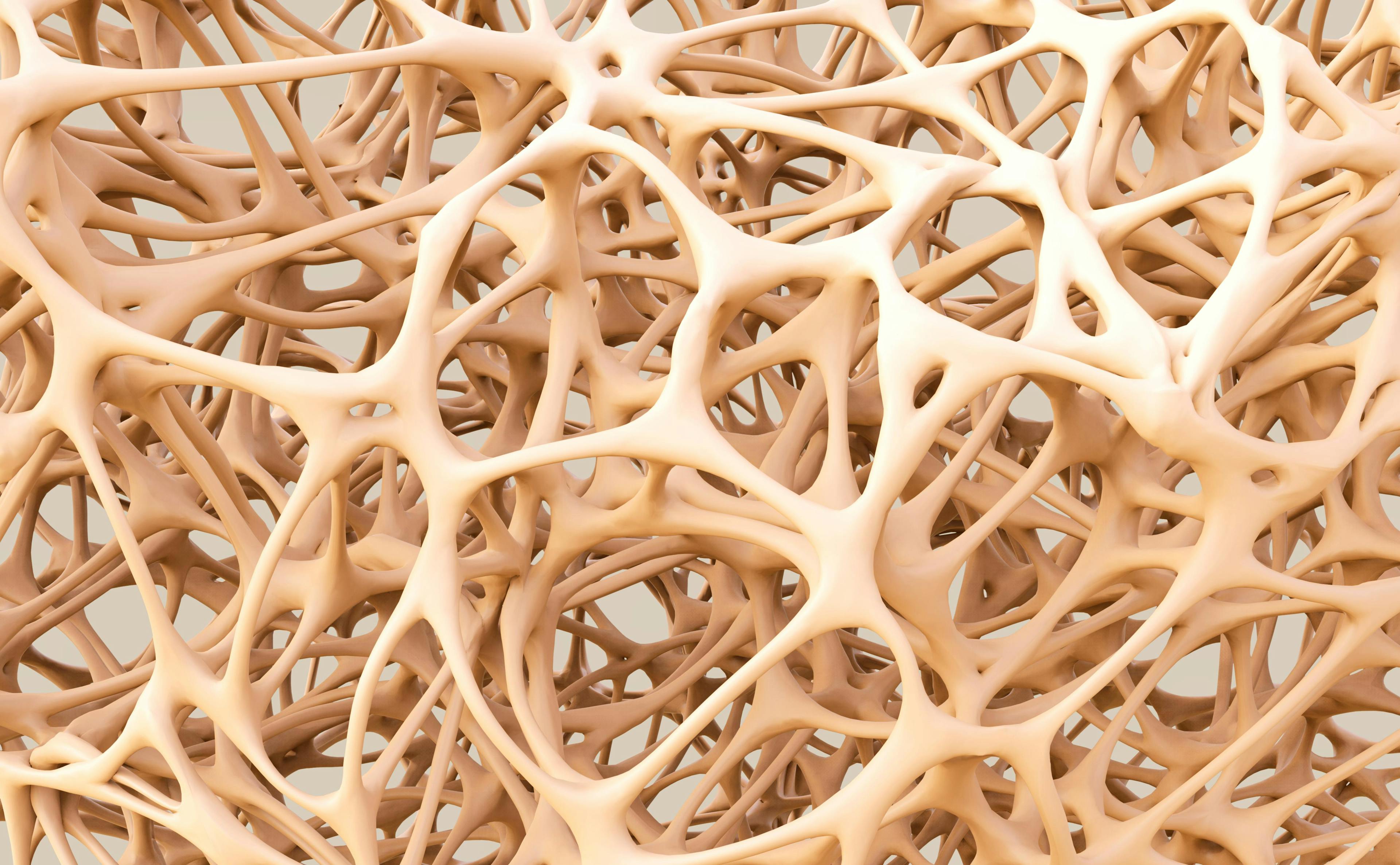 Illustration of porous bone structure.
