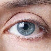 Vitiligo Patients Likely Prone to Abnormal Eye Health Issues