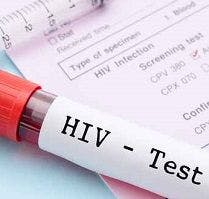 infectious disease, HIV/AIDS, menâ€™s health, pre-exposure prophylaxis, PrEP, gay, bisexual, LGBT
