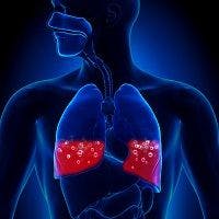 COPD Independently Increases Cardiovascular-Related Mortality, Not Stroke