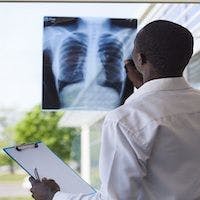 FEV1 May Not Be Significant Predictor of COPD Exacerbations