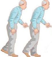 Parkinson's occupational therapy, physiotherapy, physical therapy, rehabilitation, brain, neurology