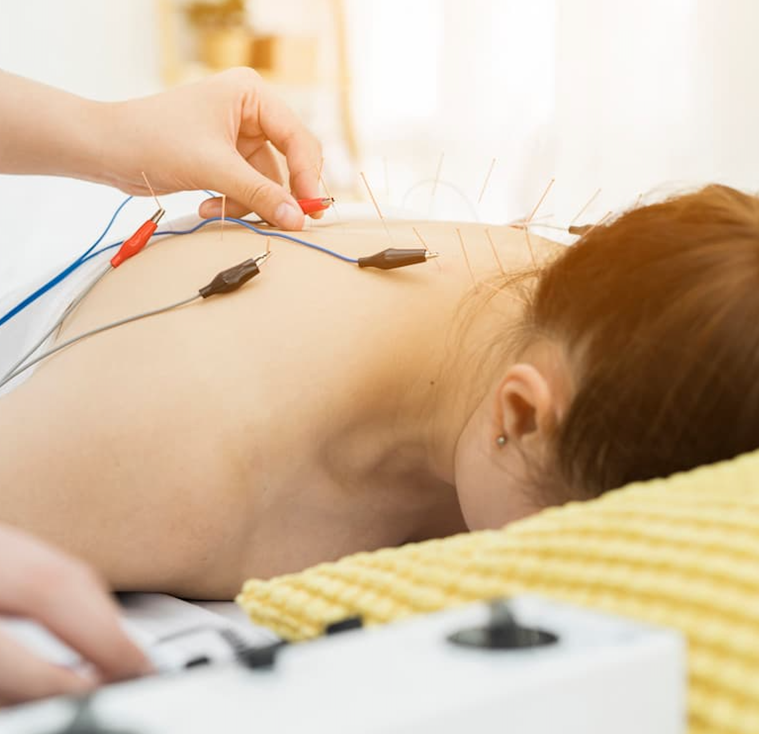 Electroacupuncture Effectively Treats Gouty Arthritis 