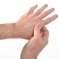 Rheumatoid Arthritis Patients Prioritize Quick Relief Above All Else