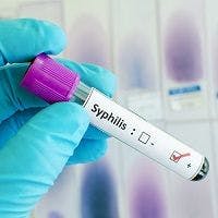 HIV Treatment Could Be to Blame for More Syphilis Cases