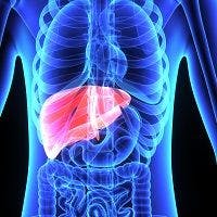 Hopeful News on Rare, Incurable Liver Disease: Primary Sclerosing Cholangitis
