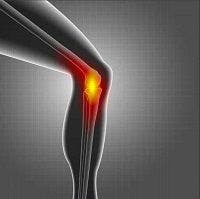 Knee Pain: Could Interventions Be the Alternative to Total Knee Replacement?