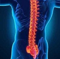 Spinal Metastases' Pain Ablated