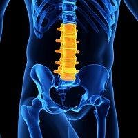 PREVENT Trial Data Supports Use of Secukinumab for Spondyloarthritis