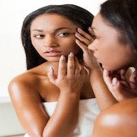 New Acid Treatment for Darker Skinned Acne Patients