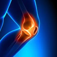 Knee Replacement Outcomes in Rheumatoid Arthritis vs. Osteoarthritis