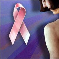 New Breast Cancer Survivorship Guidelines Aim to Help Patients Transition After Care