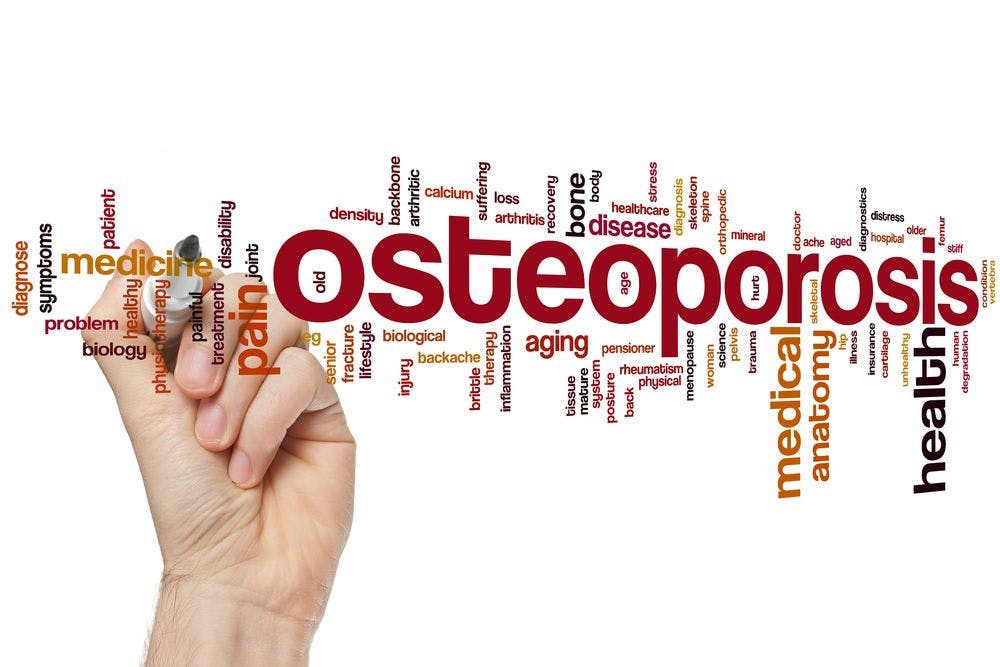 Are Osteoporotic Fractures Preventable in Spondyloarthritis? 