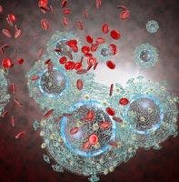 HIV Plus Depression Means Higher Mortality Risk