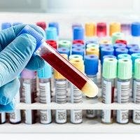Late HIV Testing Drives Transmission Rates