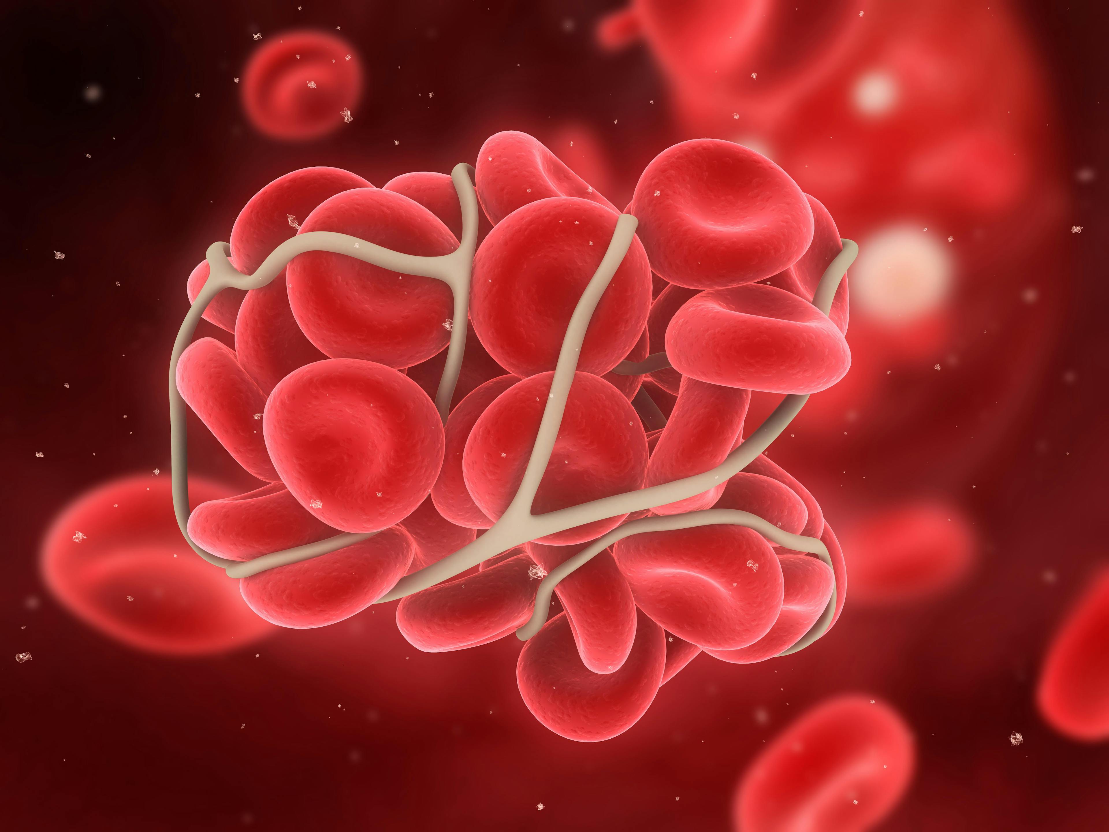 Digital illustration of a blood clot