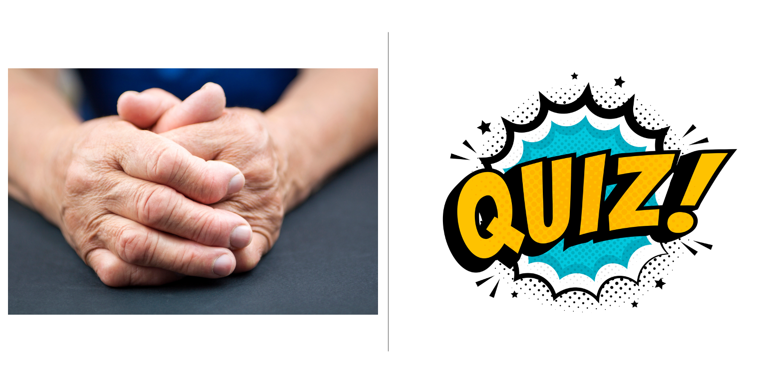 Rheumatoid Arthritis Quiz: Predisposition to RA