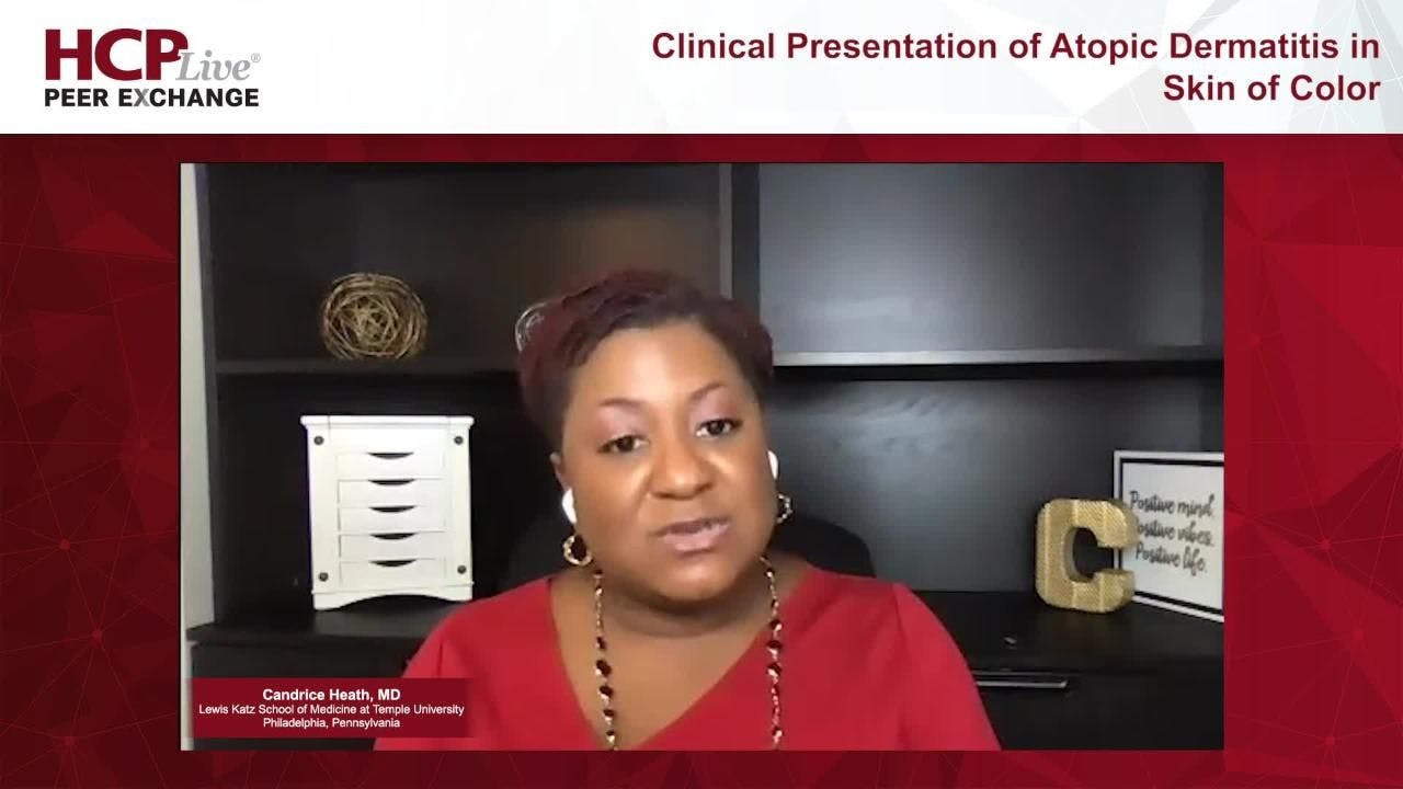 Diagnosing and Assessing AD in Patients With Skin of Color 