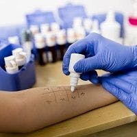 Patient Fears, Records Reduce Penicillin Allergy De-labeling Efforts