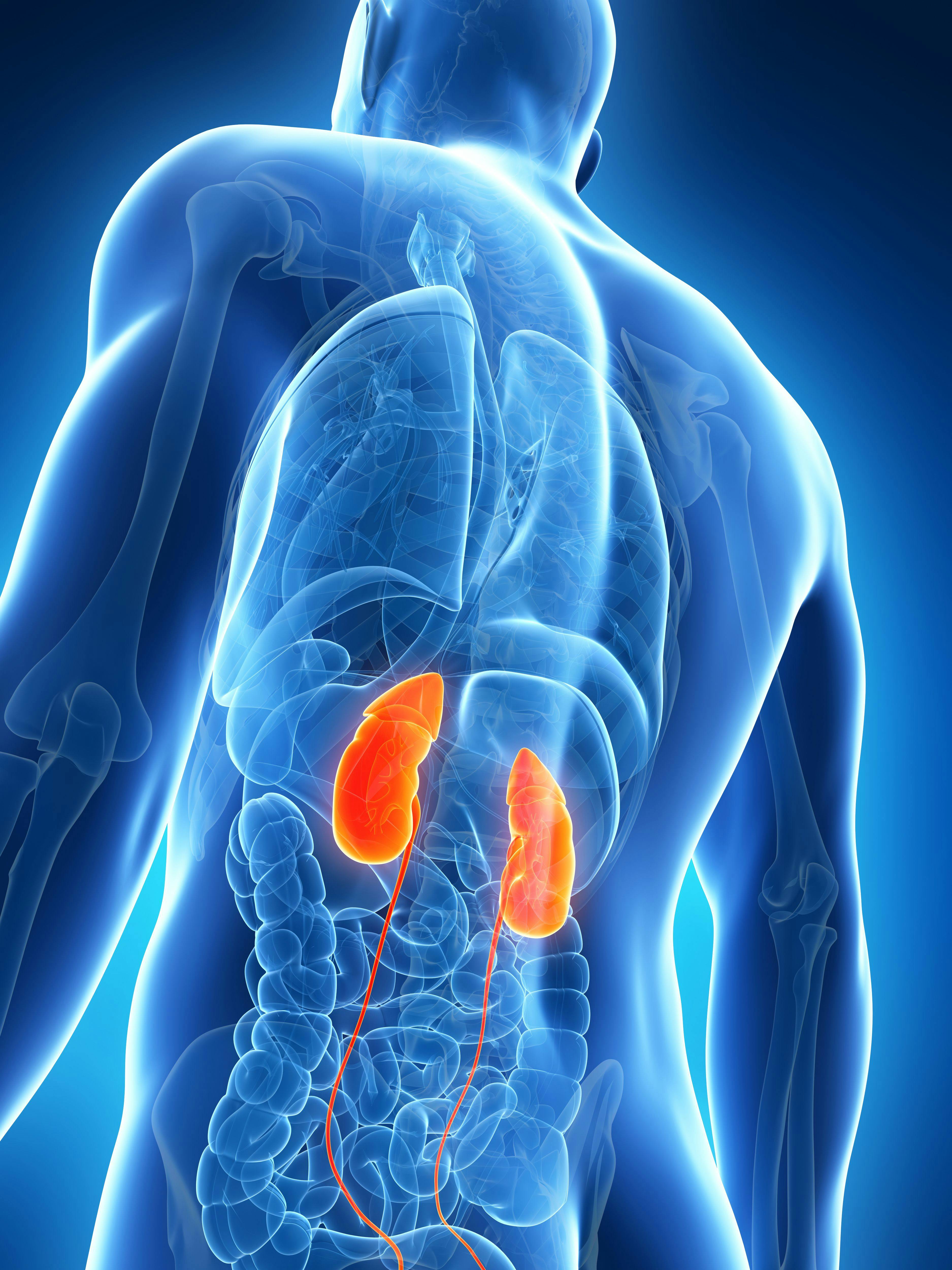 Study Supports Renal Biomarker Candidate for Proliferative Lupus Nephritis Chronicity