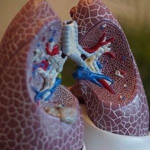 A model depicting the vascular system within a set of lungs.