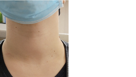 An image of a patient's neck