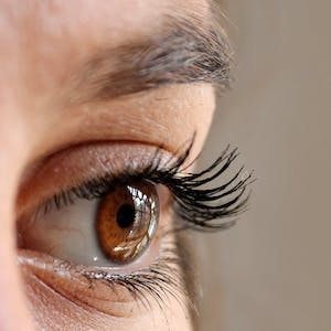 SGLT-2 Inhibitors Reduce Glaucoma Risk in Type 2 Diabetes Patients