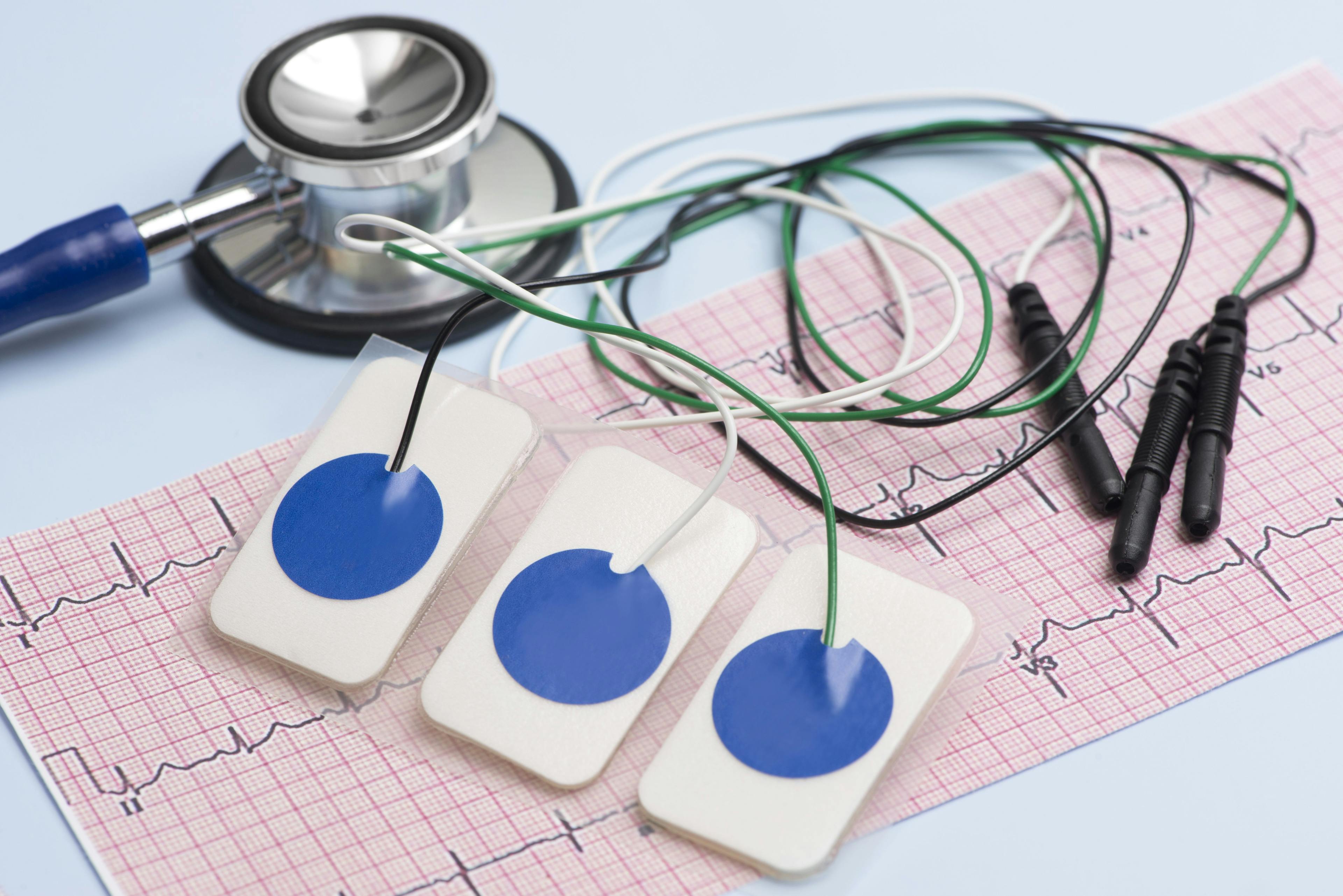 Medical equipment used to assess arrhythmias.