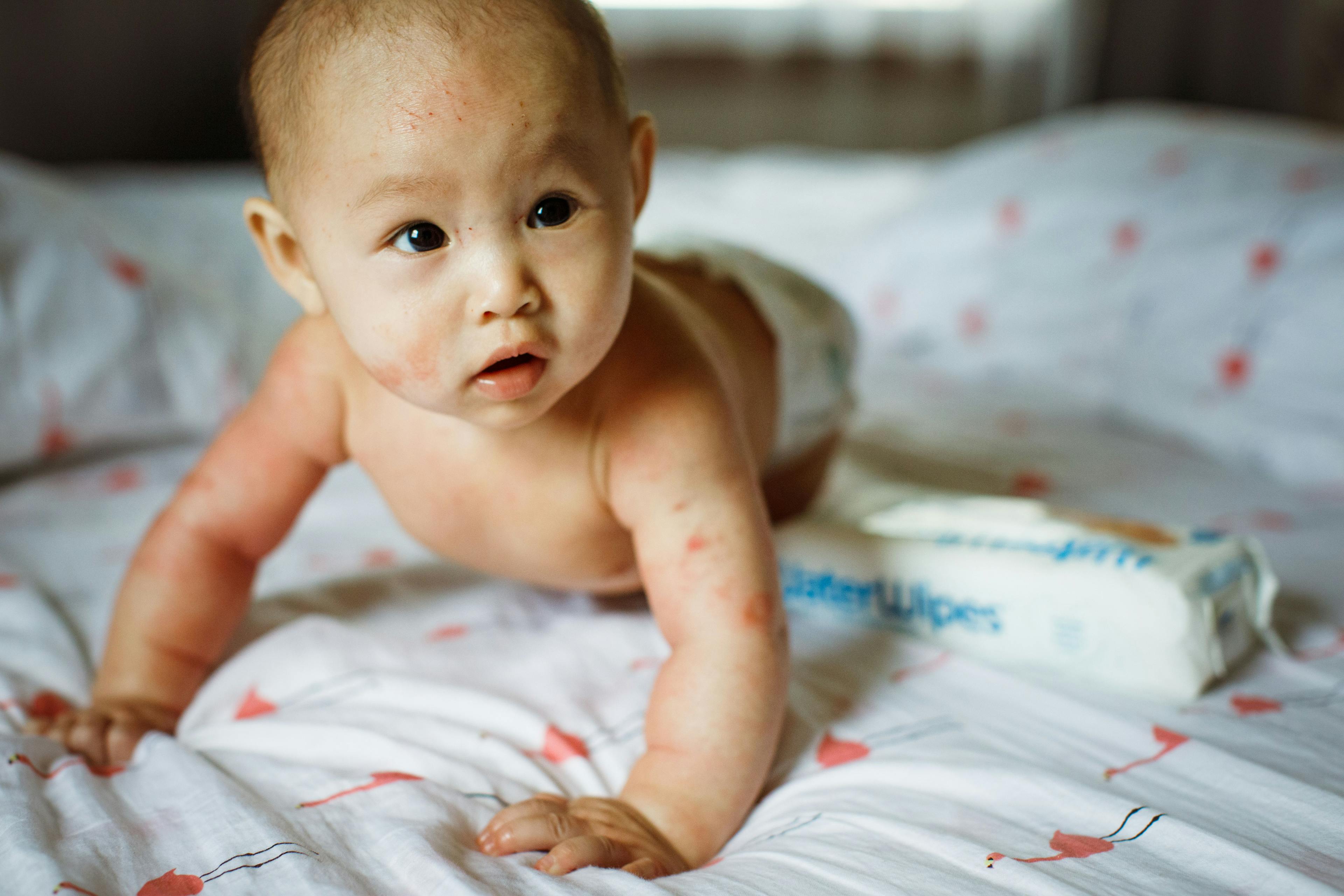 Atopic Dermatitis Prevention: Evidence-Based Infant Skin Care for the Primary Care Office