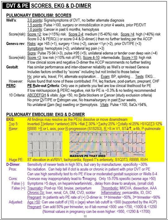 EKG in PE from The Emergency Medicine 1-Minute Consult 
