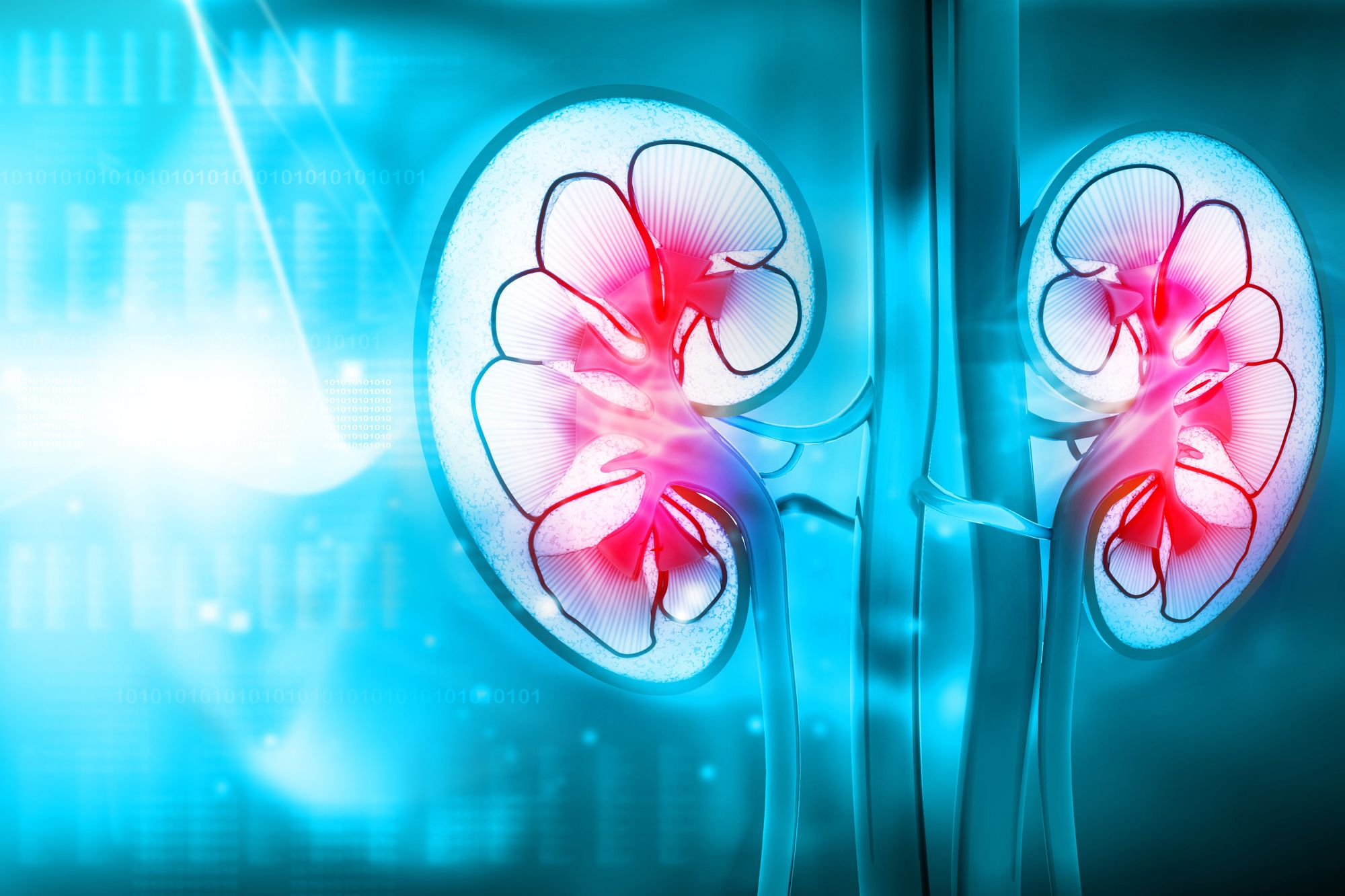 Finerenone Reduces Risk of Negative Kidney Outcomes, Regardless of CKD Severity