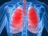 The Link between Diet and Lung Function in COPD Patients