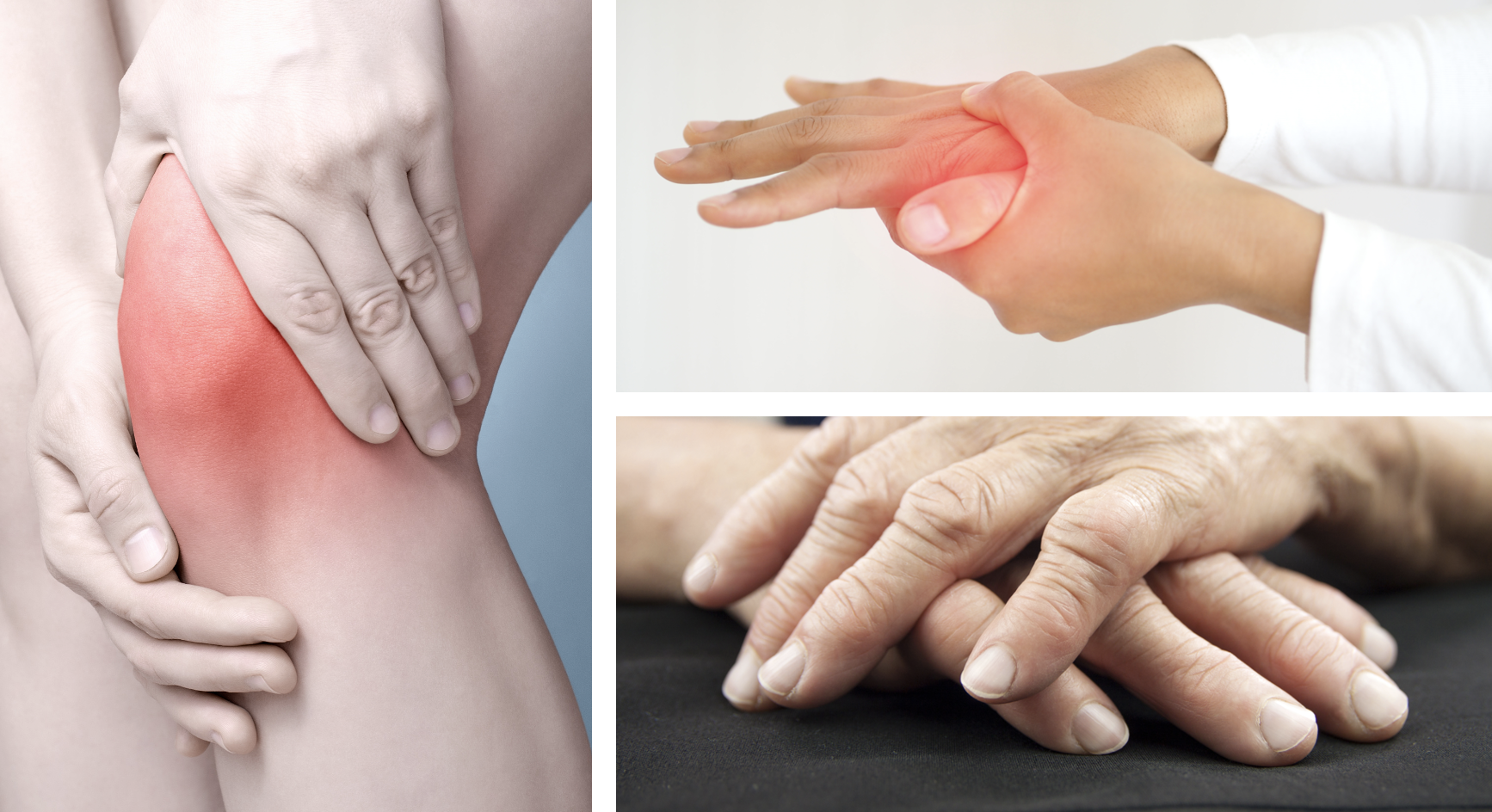 The 2021 Treatment Guidelines for Rheumatoid Arthritis
