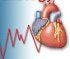 Online CME: Angina