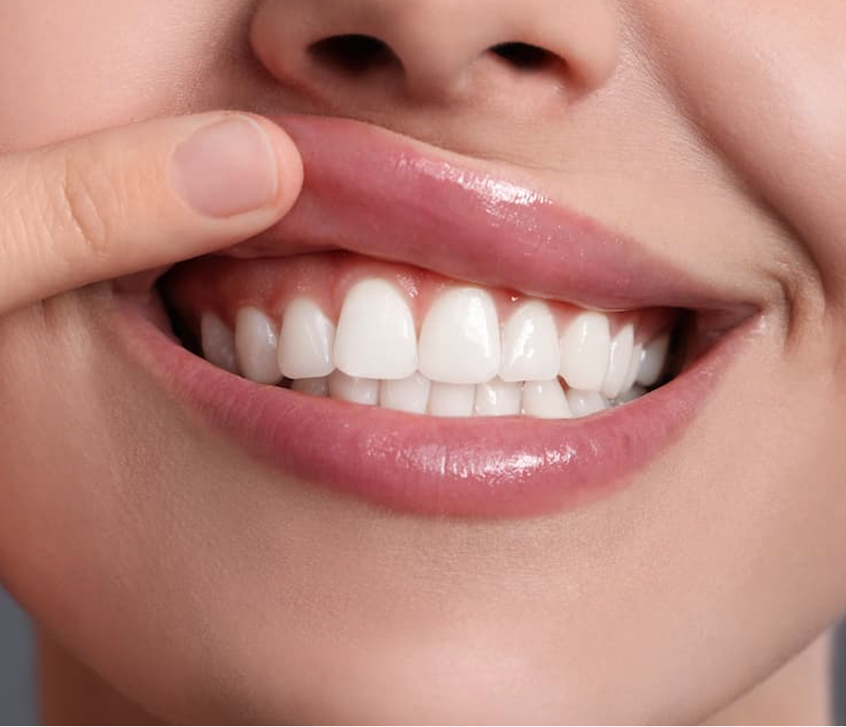 Study Reveals Link Between Periodontitis and Increased Blood Uric Acid Levels