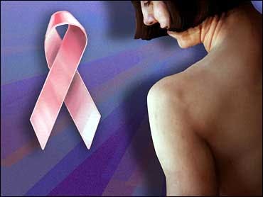 Acupuncture May Soothe Painful Side Effects Associated with Hormone Treatment for Women with Early Breast Cancer