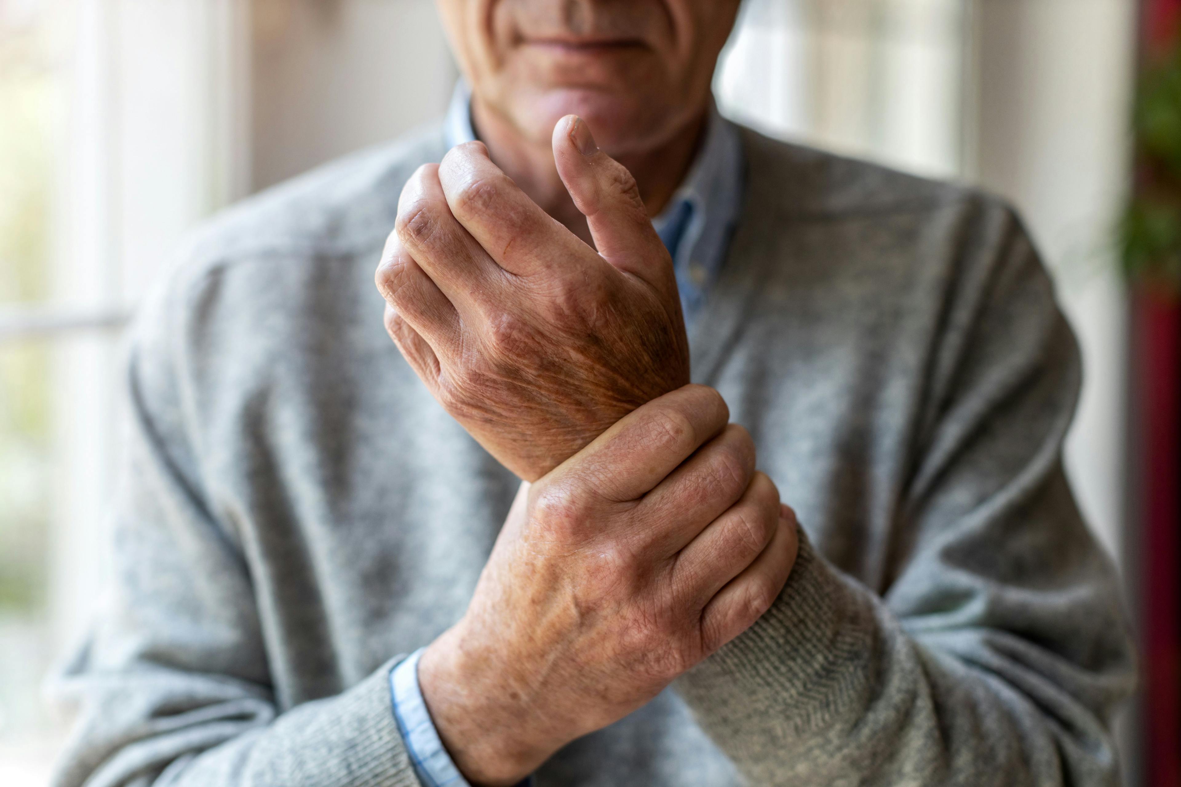 Inflammatory Arthritis: Trends, Risk Factors, and What Rheumatologists Need to Know