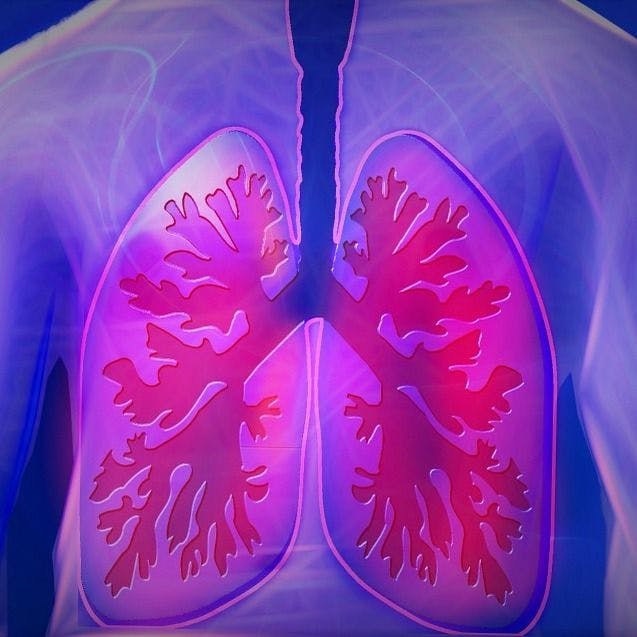Mepolizumab Shown to Reduce Exacerbations in COPD Patients