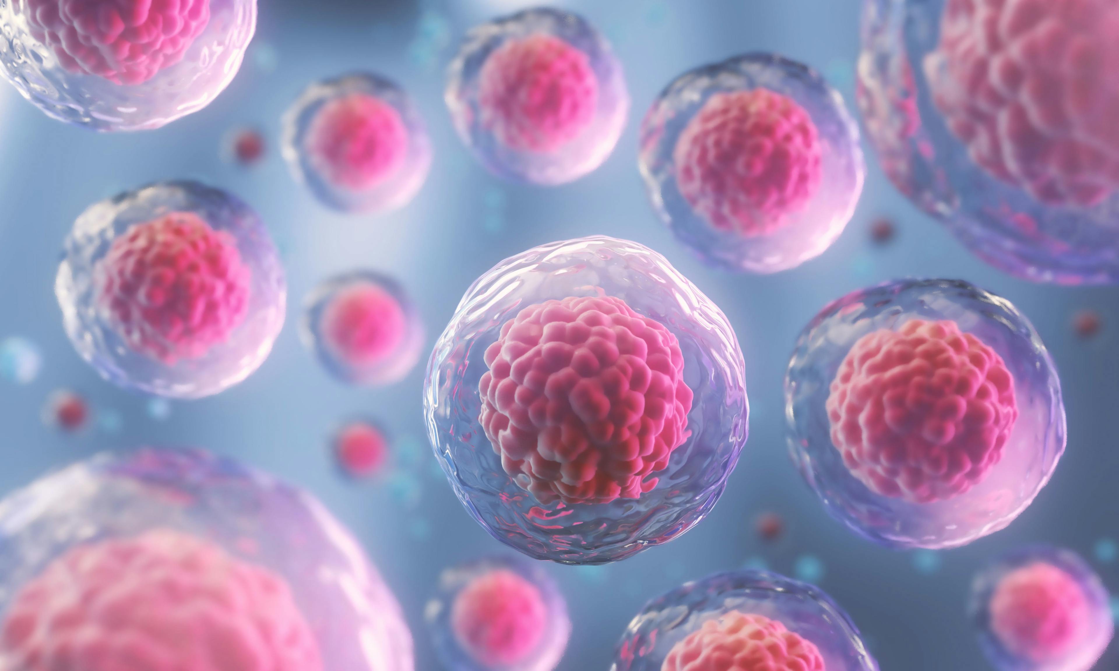 Stem Cells Show Promise for Nonhealing Diabetic Foot Ulcers in Phase 1 Trial