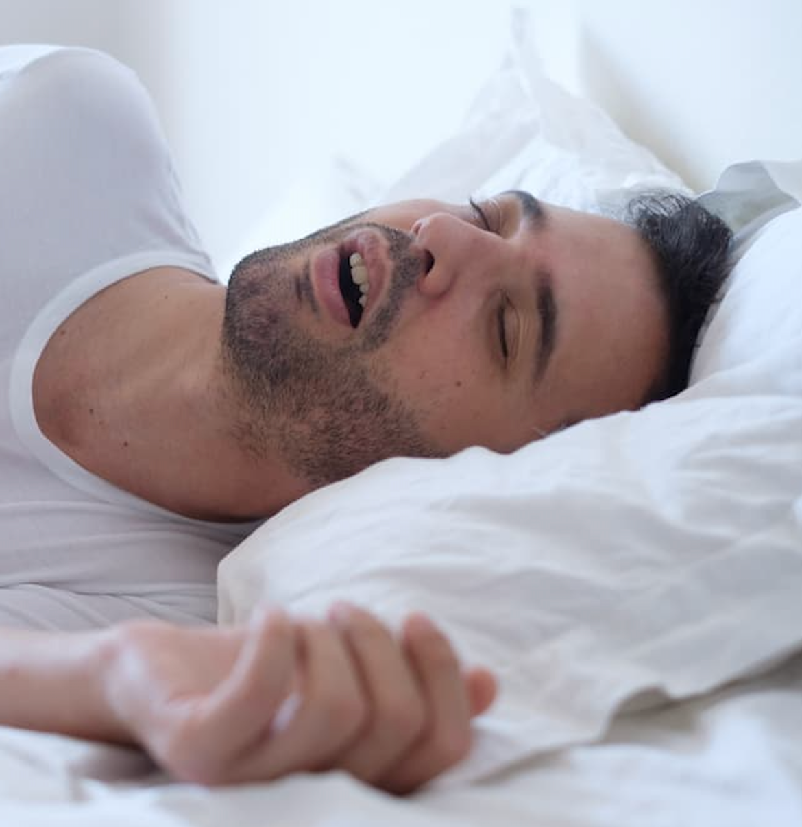 Obstructive Sleep Apnea Linked to Gout Diagnosis