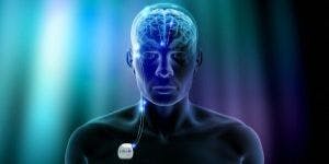 Deep Brain Stimulation Depression Trial to Expand