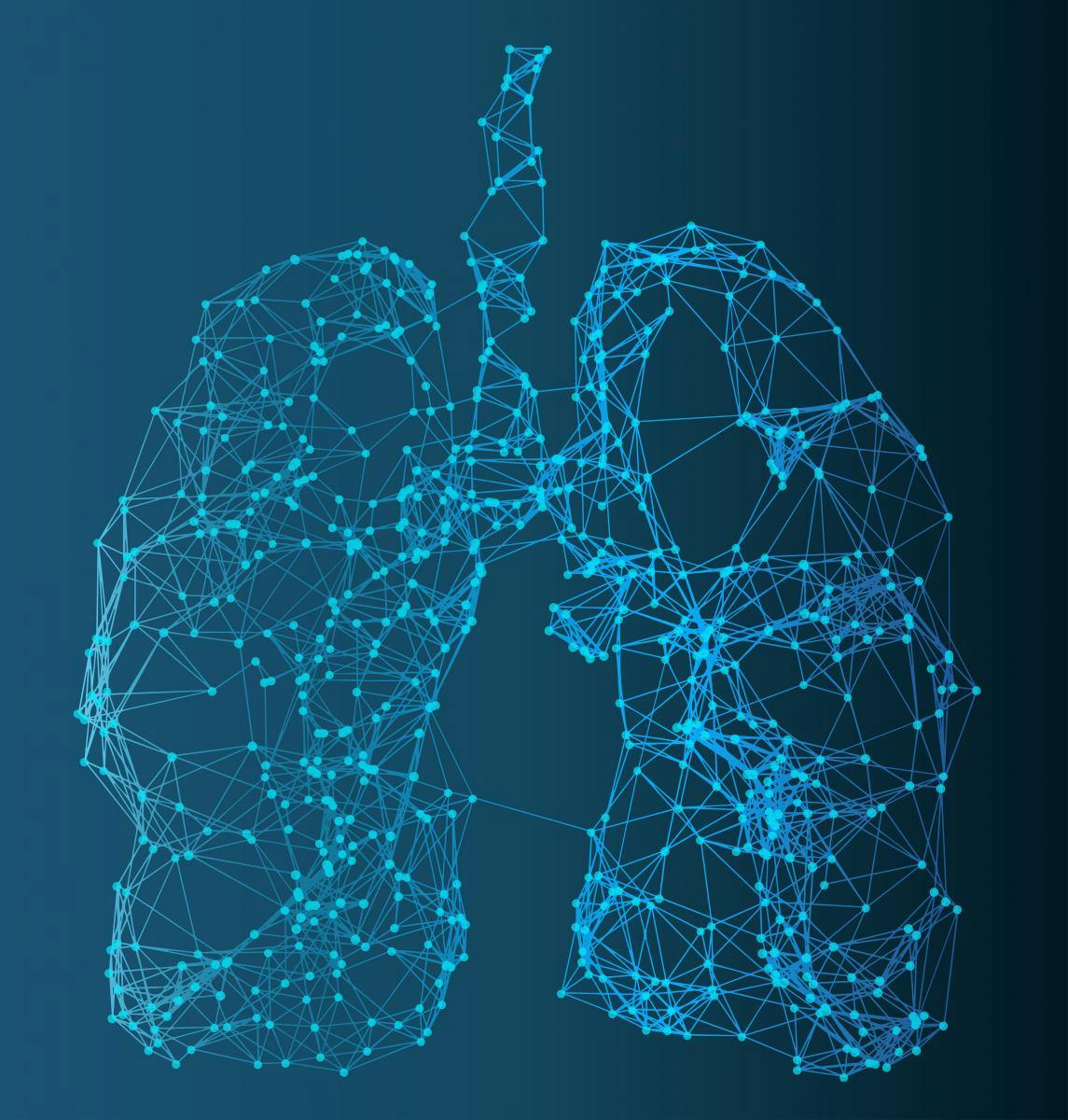 Molecular Source of Idiopathic Pulmonary Fibrosis Identified