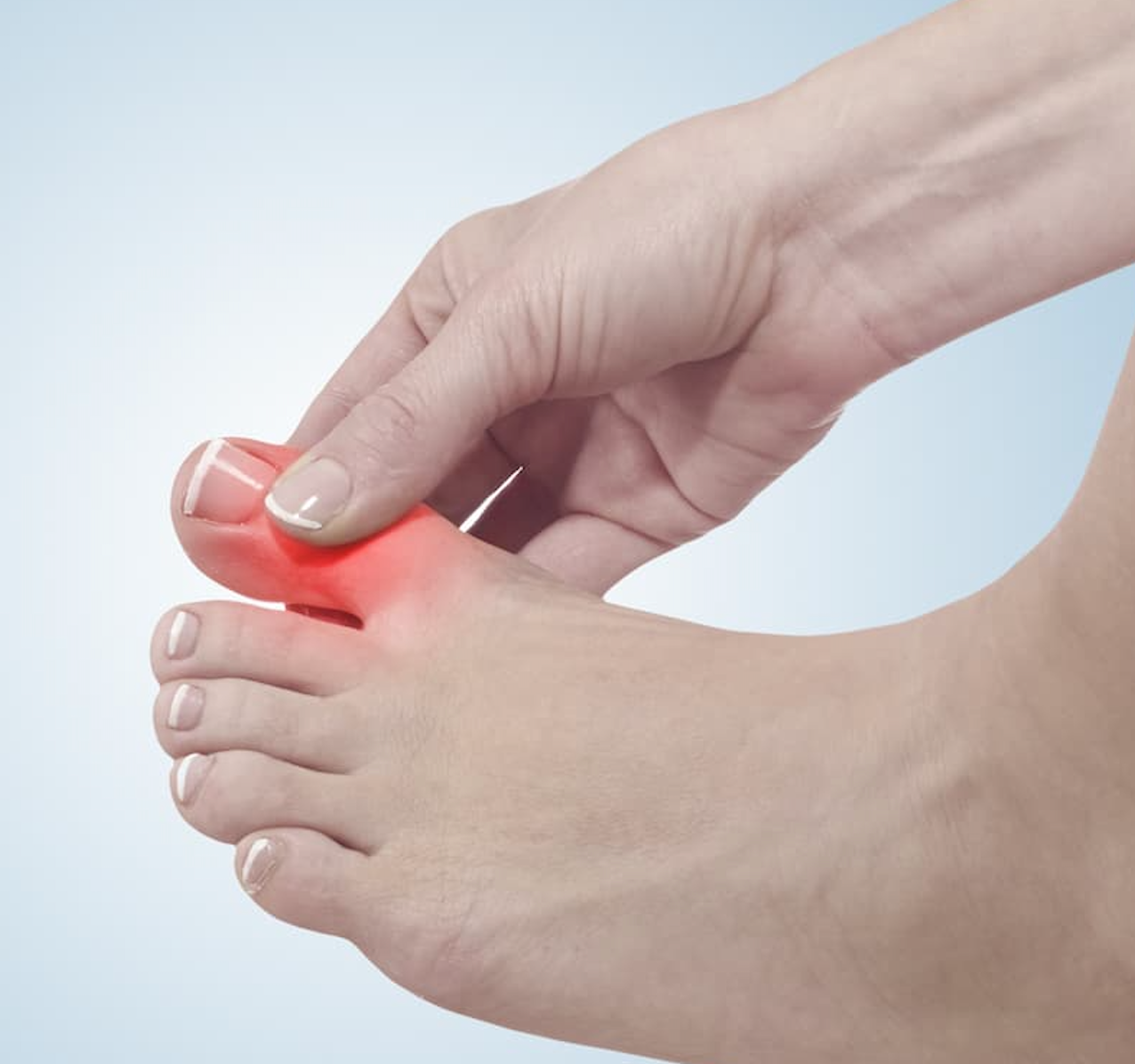 Decreased Dementia Rates Observed in Patients With Gout
