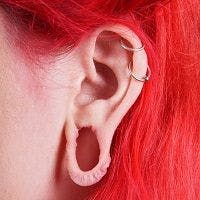 Un-Stretching Gauged Earlobes: Surgical Repair