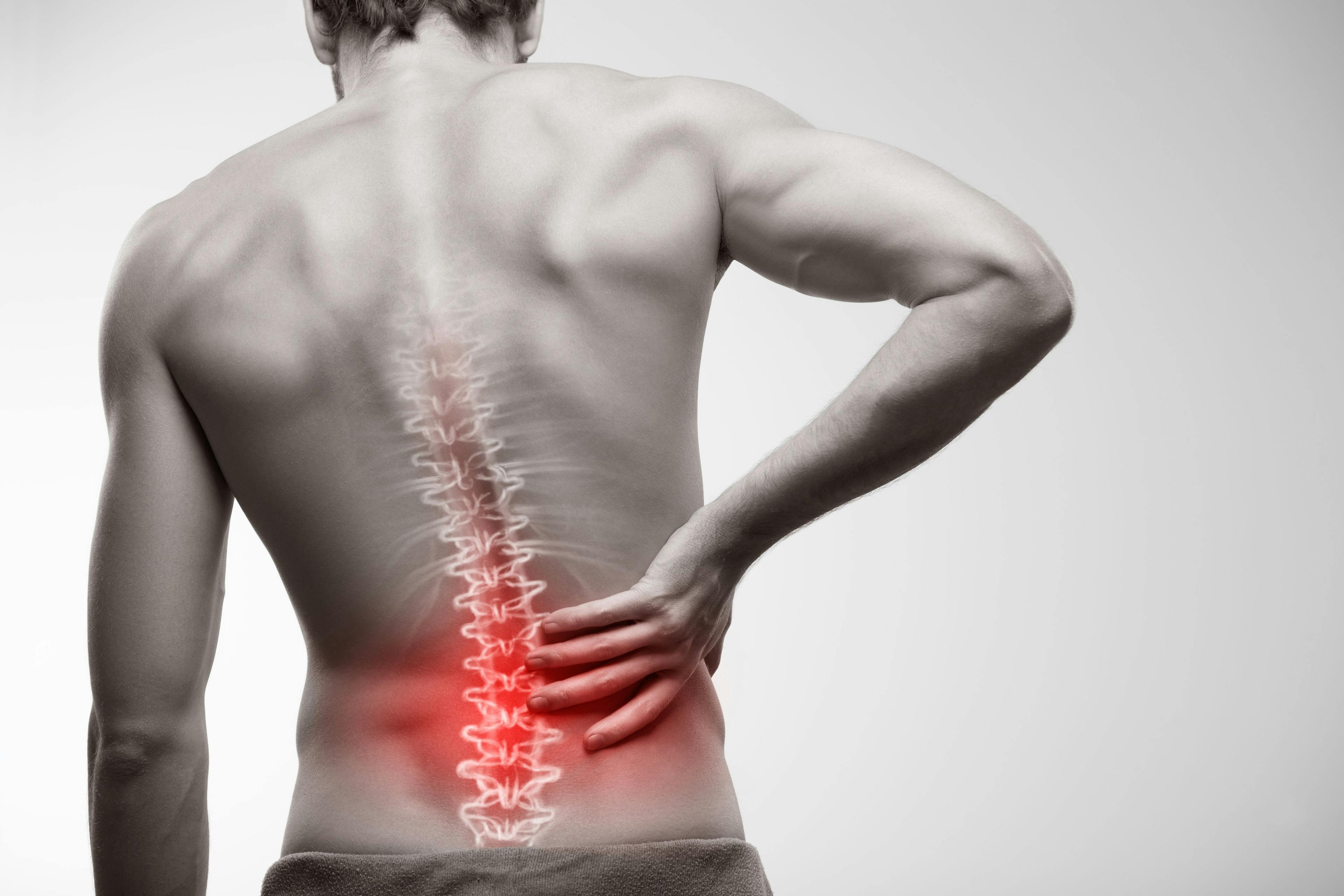 Secukinumab Improves Spinal Pain in Patients With Axial Spondyloarthritis 