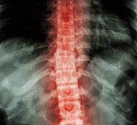 Promising Drug for Spinal Cord Injury